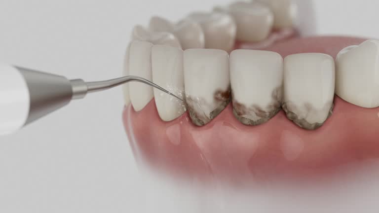 Reliable Root Canal Treatment contractor in Clay County County, KY by Dentist Open Now